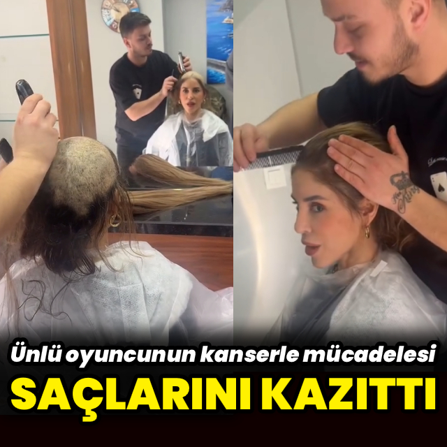 Kanserle Mücadele Eden Irmak Ünal, Saçlarını Kazıttı
