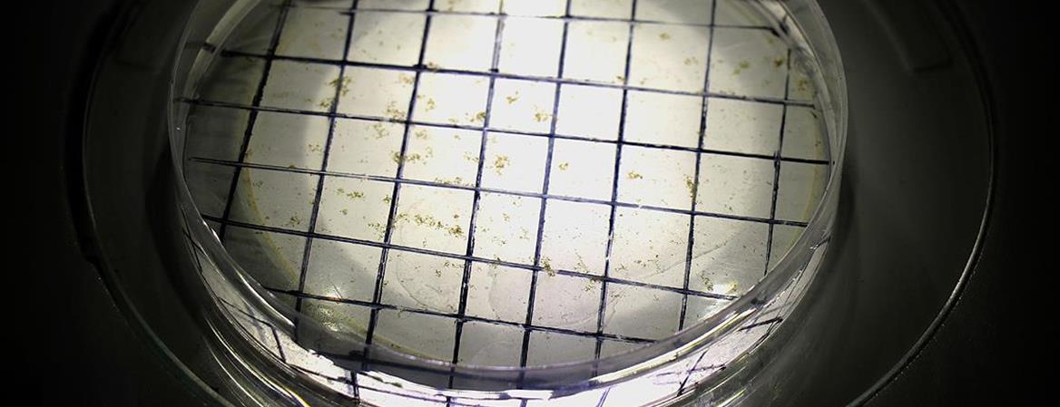 Antimikrobiyal Dirençle Mücadele için Uluslararası Proje Çağrısı Başladı